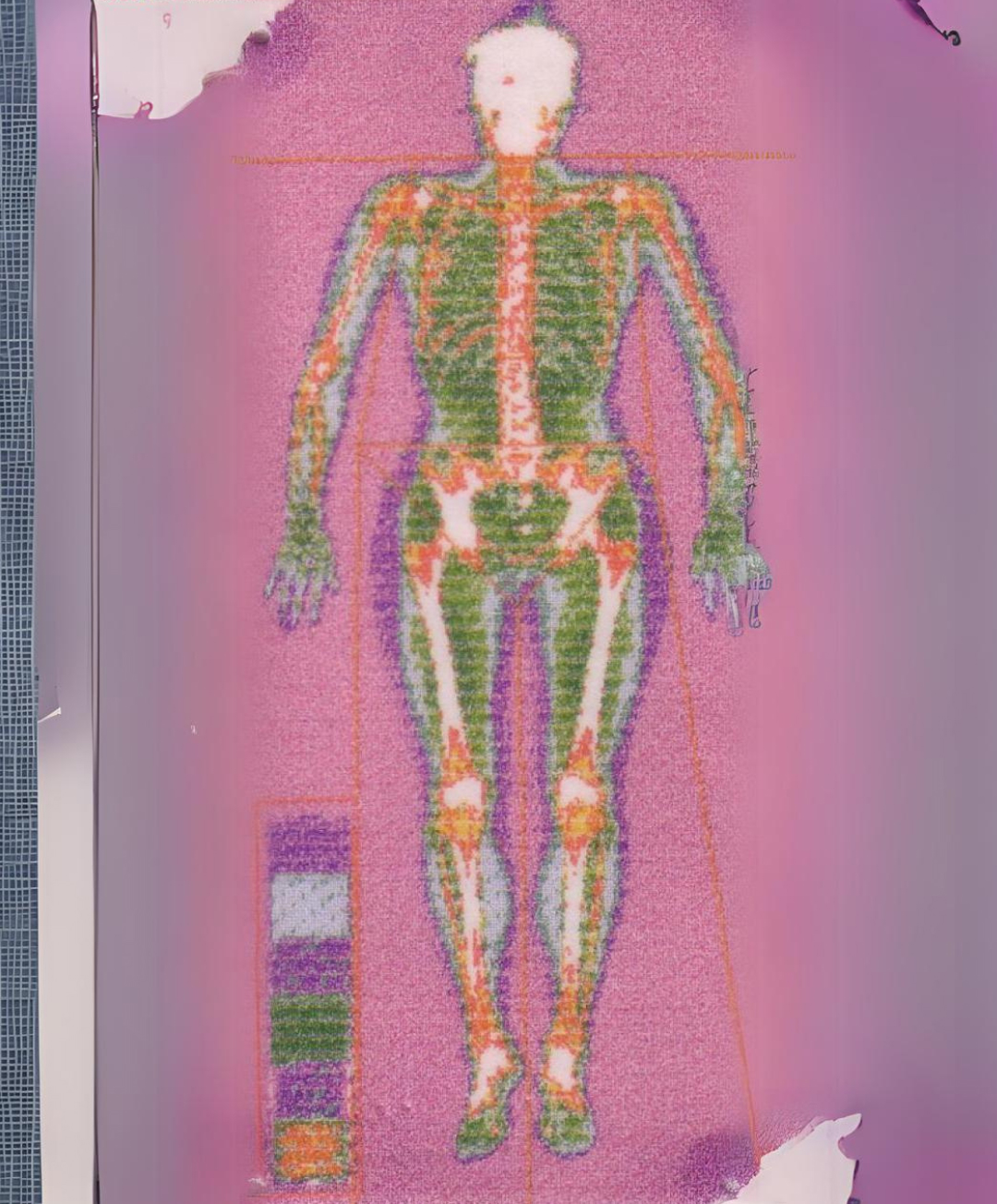 Darstellung einer Fettvermessung